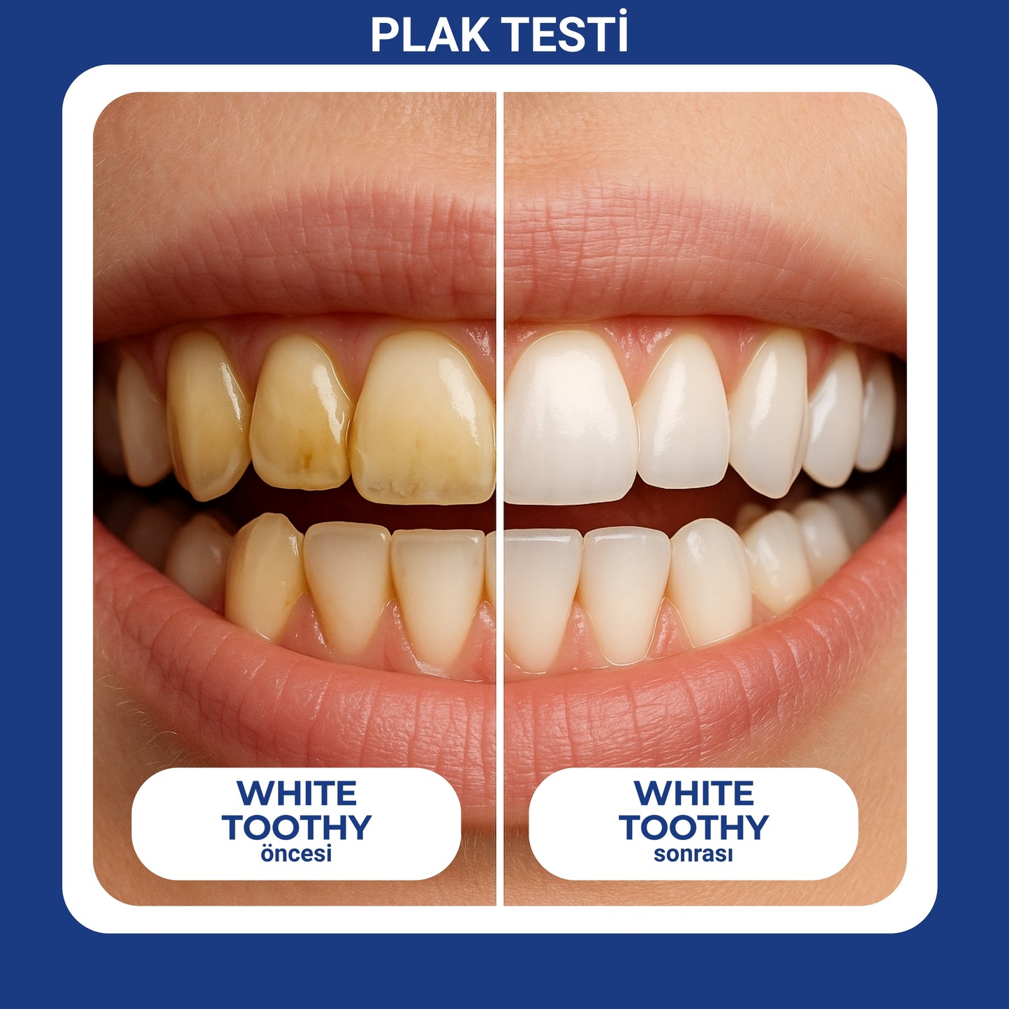 Toothy 360 Adult | Yetişkin Otomatik Diş Fırçası – Hızlı ve Derin Temizlik